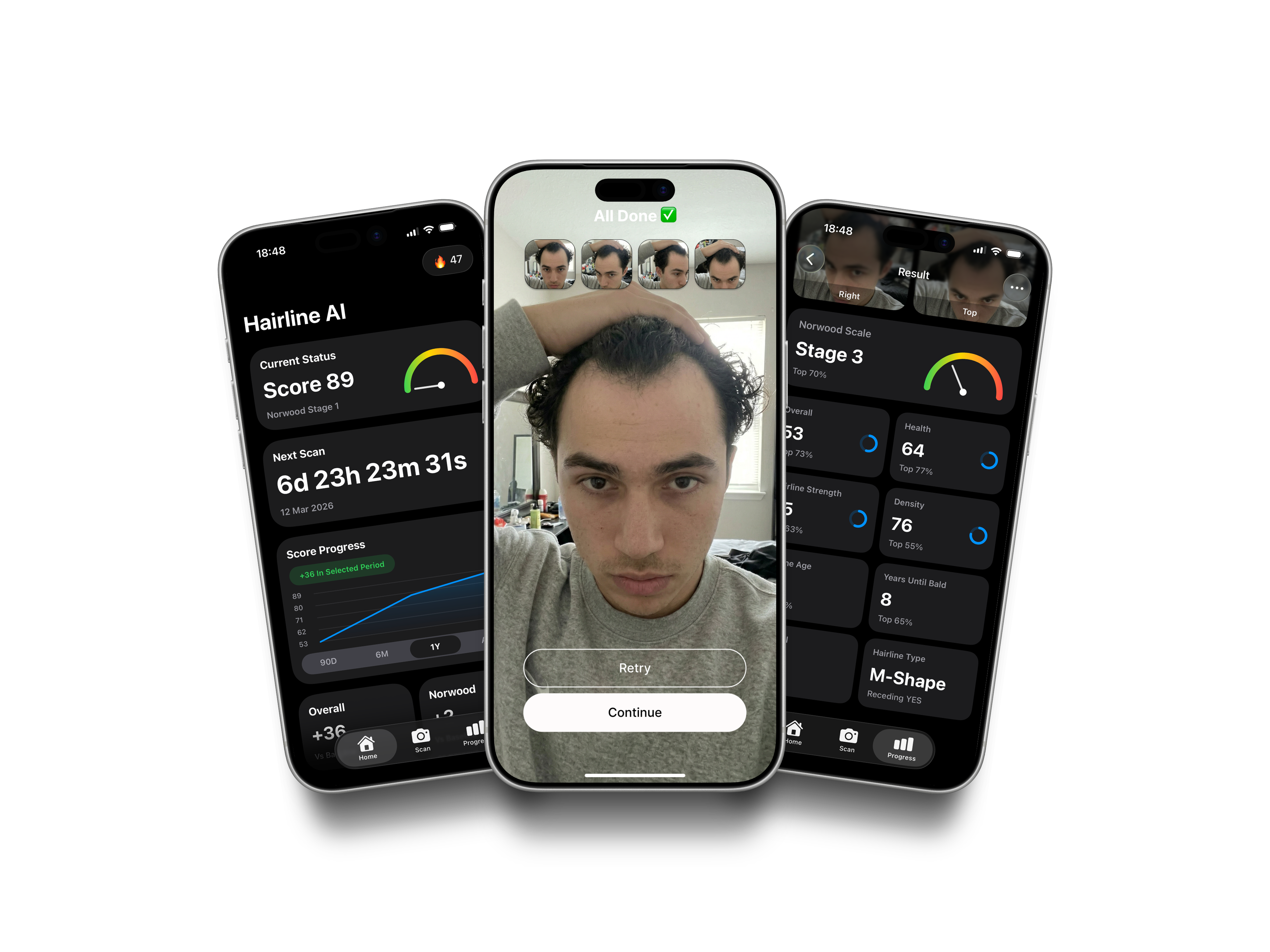 Hairline AI app demo